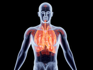 Inflammation